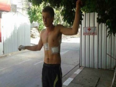 Aussie Father and Son Beaten by Gang in Chiang Mai, Police Told